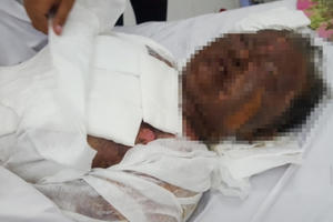 Nghịch tử tưới xăng thiêu sống mẹ