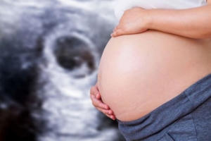 Thất kinh vì con chào đời không mặt, mắt, mũi, cha mẹ kiện bác sĩ sản