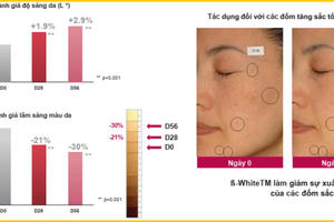 Tìm hiểu công nghệ chống nám từ Beta- White hướng đích dạng Liposome