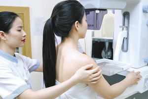 Hơn 11.000 ca ung thư vú mới mỗi năm