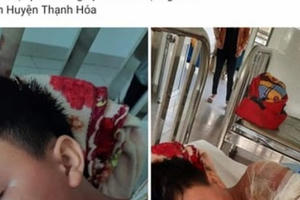 Thực hư chuyện bố đẻ đánh và dội nước sôi lên người bé trai 8 tuổi?