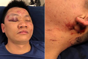 Hà Nội: Đưa con đi công viên, bị nhóm người lạ đánh bất tỉnh