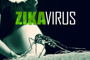 Tất cả điều mẹ bầu nên biết về virus Zika Tất cả điều mẹ bầu nên biết về virus Zika