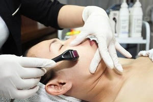 Lăn kim làm đẹp – lăn rủi ro Lăn kim làm đẹp – lăn rủi ro