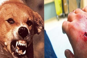 Cụ bà tử vong vì lên cơn dại sau khi bị chó hàng xóm cắn