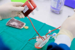 Liệu pháp tế bào gốc: “Cửa sống” cho các bệnh nan y