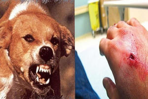 67 người chết vì chó dại cắn trong 9 tháng đầu năm