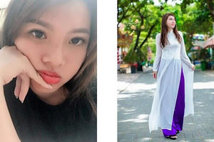 Cơn lốc “phẫu thuật thẩm mỹ” và những nỗi đau có thật