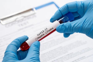 Đã có kết quả xét nghiệm mẫu bệnh phẩm trường hợp tử vong khi đi xe khách từ Hà Nội về Nghệ An