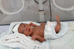 Bệnh viện tuyến huyện lần đầu nuôi sống bé sinh non 900g