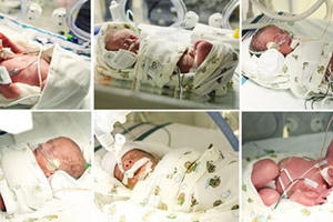 Hy hữu ca mang thai 6 thành công