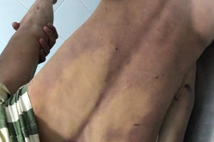 Đồng Nai: Điều tra nguyên nhân nam thanh niên tử vong nghi do bị đánh trong buồng tạm giam