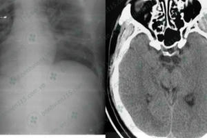 Tài xế hôn mê sâu khi lái xe chỉ vì quên ăn sáng