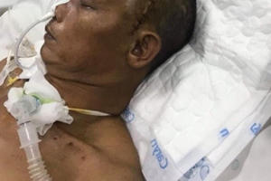 Hoãn phiên tòa phúc thẩm vụ án thương binh bị đánh thương tổn 80% sức khỏe