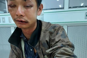 Đắk Lắk: Mâu thuẫn trong lúc chơi bài ăn tiền, 1 người bị đâm tử vong