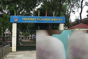 Vụ cô giáo đánh tím tay học sinh: Do học sinh chậm tiếp thu bài?