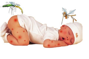 Trường hợp sốt như thế nào cần đưa trẻ đi xét nghiệm máu?