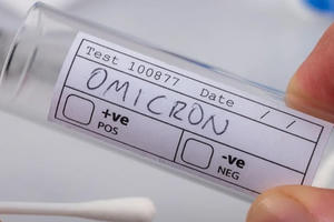 COVID-19: Biến chủng Omicron dễ lây nhưng 'hiền' hơn?