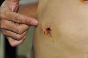 Đồng Nai: Dân "tố" công an dùng súng bắn trọng thương