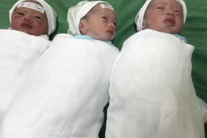 Sản phụ “vượt cạn” bằng phương pháp tự nhiên sinh 3 hiếm gặp