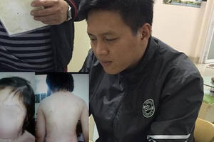 Đề nghị khởi tố ông bố bạo hành con ruột khiến xã hội phẫn nộ