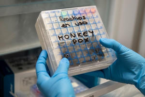 WHO họp khẩn, cân nhắc đậu mùa khỉ là tình trạng khẩn cấp toàn cầu