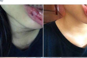 Vụ MC Minh Tiệp bị tố bạo hành: Cơ quan chức năng làm việc với gia đình nữ sinh