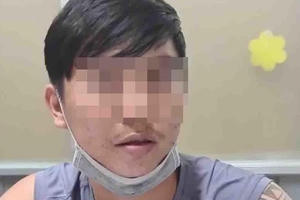 Lâm bước đường cùng, bịa chuyện bị cướp tấn công để trốn nợ