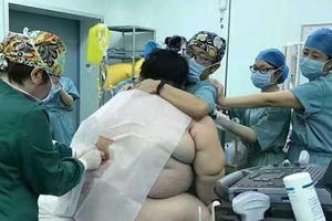 Đỡ đẻ cho thai phụ nặng 140kg, gần 20 bác sĩ "toát mồ hôi"