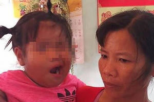 Vụ bé 3 tuổi liệt dây thần kinh số 7 nghi do cô giáo đánh: Công an vào cuộc xác minh