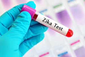 Đã tìm thấy kháng thể chống virus Zika