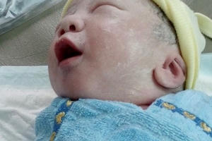 Bệnh viện Sản Nhi tỉnh Hậu Giang đã sinh mổ thành công cho một thai phụ nhiễm Covid-19