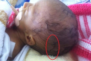 Mổ đẻ làm rách đầu trẻ, giám đốc vẫn cho rằng 'việc không lớn' Mổ đẻ làm rách đầu trẻ, giám đốc vẫn cho rằng 'việc không lớn'