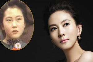 Phẫu thuật thẩm mỹ: được và mất