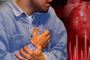 Bệnh nhồi máu cơ tim: Những cái chết không được báo trước