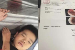 Cô giáo đánh loạt học sinh tại Hải Phòng: Công an đề xuất hình thức xử lý