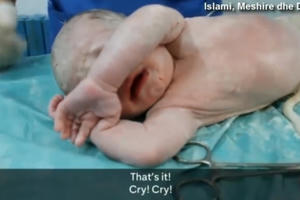 Nỗ lực phi thường cứu sống 2 mẹ con bà bầu