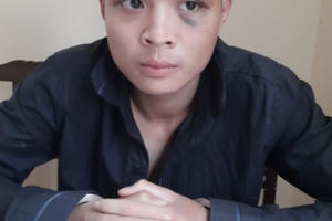 Vừa về quê, nam thanh niên liền đột nhập cửa hàng trộm 8 điện thoại