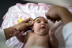 Việt Nam phát hiện trường hợp trẻ sơ sinh đầu tiên nghi mắc chứng đầu nhỏ do virus Zika