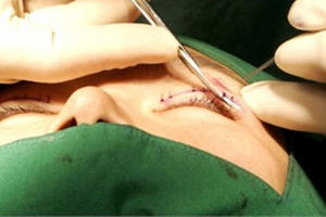 Ký ức đau đớn của ca sĩ Việt chuyển giới trên đất Thái