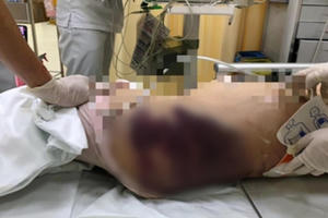 Bắt khẩn cấp “dì ghẻ” nghi bạo hành bé gái 8 tuổi tử vong ở TP HCM