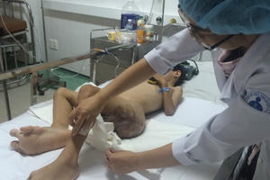 Cậu bé 6 tuổi mang nhiều bướu máu dũng cảm đối mặt cái chết