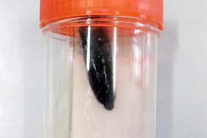 Đỉa dài 5cm ở trong đường thở của bé gái 9 tuổi suốt 2 tháng