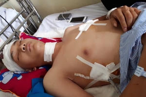 Hà Nội: Khởi tố vụ án hai nam thanh niên bị nhóm người lạ mặt đuổi chém trong đêm