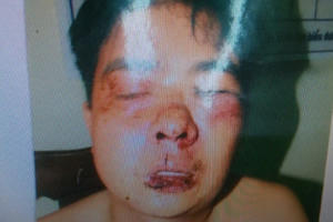 Kỳ 5 - Lâm Đồng: Bị cáo suy giảm sức khỏe nghiêm trọng, có dấu hiệu vi phạm tố tụng?