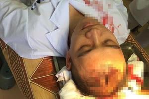 Bộ Y tế lên tiếng vụ bác sỹ Bệnh viện Đa khoa Thạch Thất bị hành hung