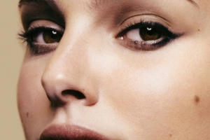 Hãy đi khám ngay trước khi quá muộn nếu phát hiện nốt ruồi mới mọc