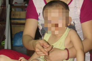 Mẹ khóc ròng chứng kiến con 20 tháng tuổi bị cắn bầm tím người