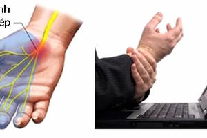 Bệnh hay gặp ở người làm báo Bệnh hay gặp ở người làm báo