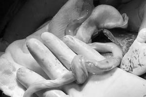 Bác sĩ bỏ ngang ca khám bệnh, lao vào phòng mổ cứu bé sơ sinh